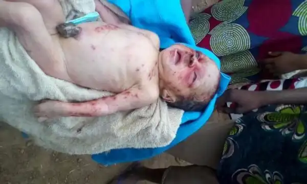 Too Bad!! Newborn Baby Dumped For A Pit Latrine In Benue State (See Photos)